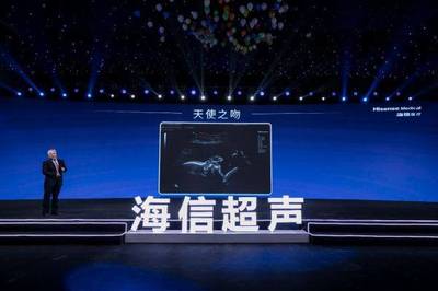 九年磨一劍 海信超聲的夢(mèng)想征程與技術(shù)突破